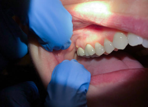 Best Walk-In Emergency Dentist in West Simsbury, CT